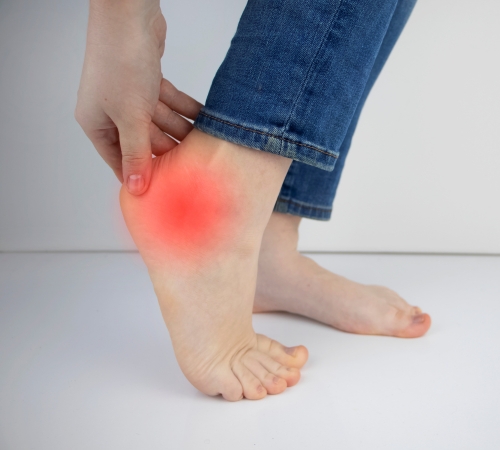 Arthritis in the Foot or Ankle