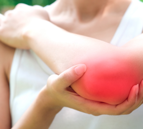 Elbow Bursitis