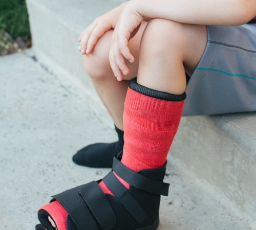 Foot or Ankle Fractures