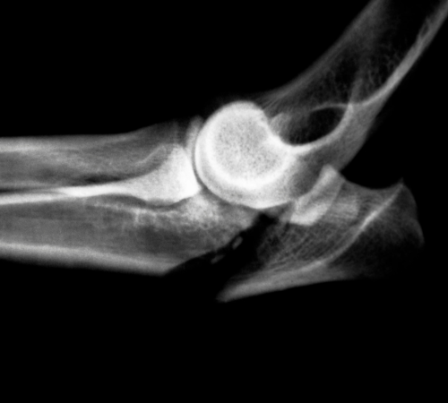 Fractures & Dislocations