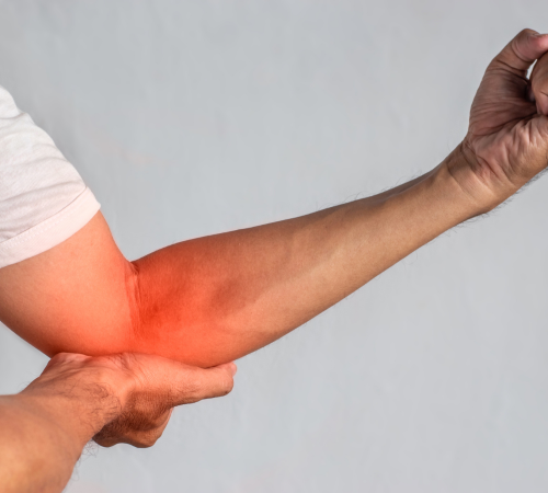 Golfer’s Elbow