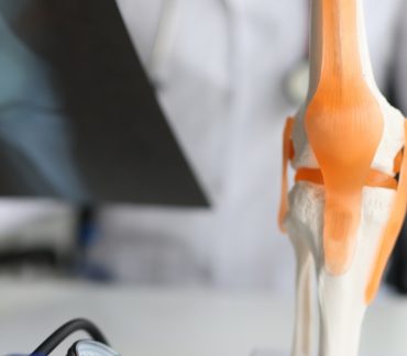 Joint Replacement