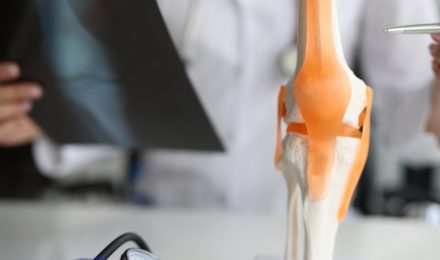 Joint Replacement