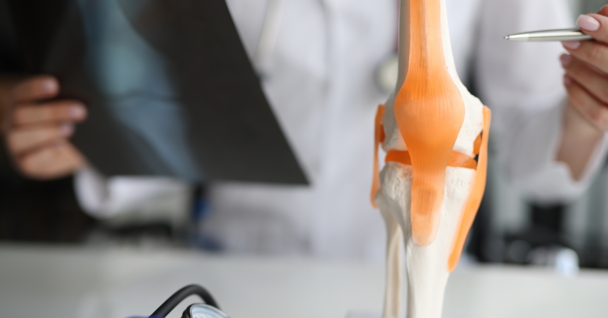 Joint Replacement