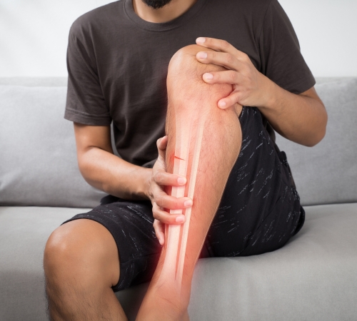 Knee Fractures