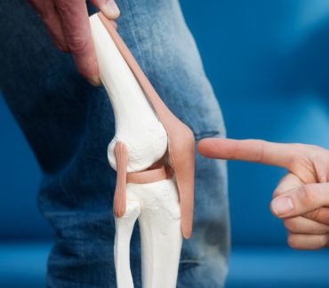 Knee Replacement Surgery