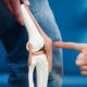 Knee Replacement Surgery
