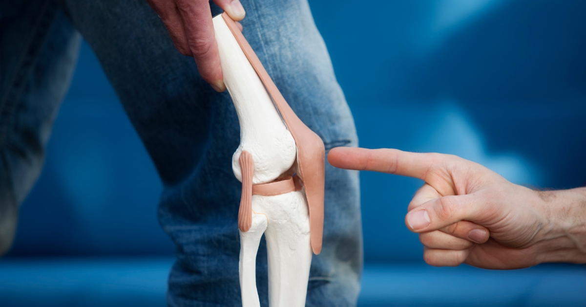 Knee Replacement Surgery