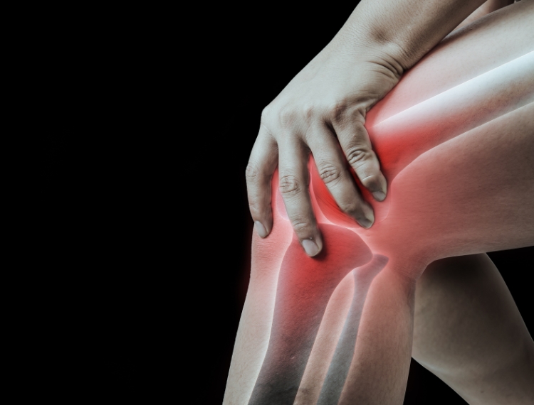 Knee Replacement