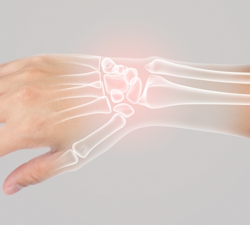 Ligament Reconstruction