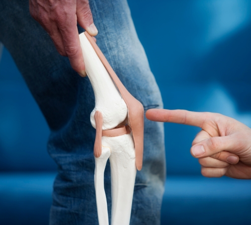 Meniscus Tear