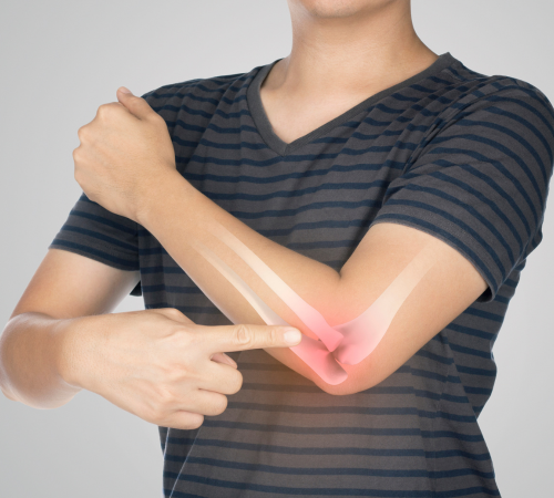 Nerve Compression