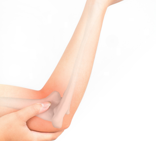 Osteoarthritis of the Elbow