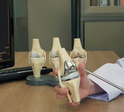 Reverse Total Shoulder Replacement