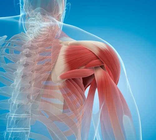 Rotator Cuff Repair