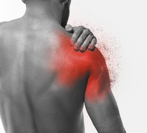 Shoulder Fracture