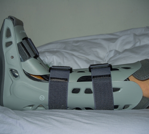 Tendon Repair Surgery