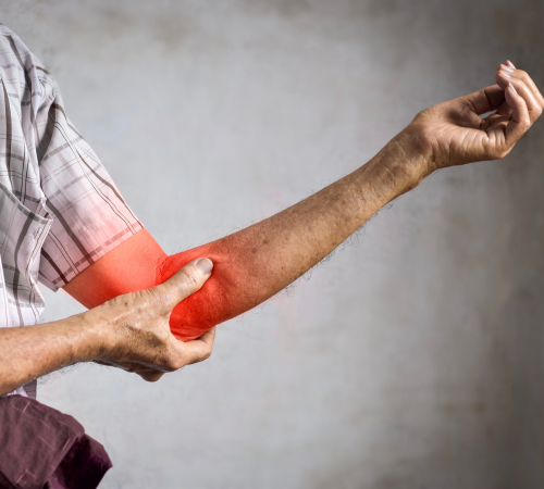 Tendon Tears and Strains