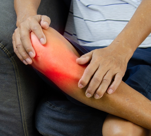 Tendon Tears or Instability