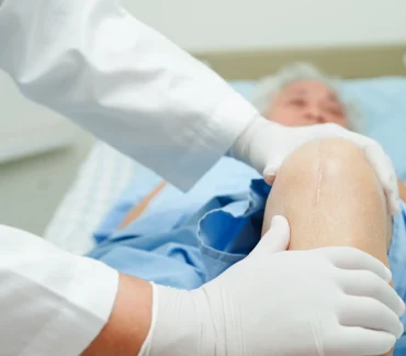 knee replacement surgeon in ahmedabad