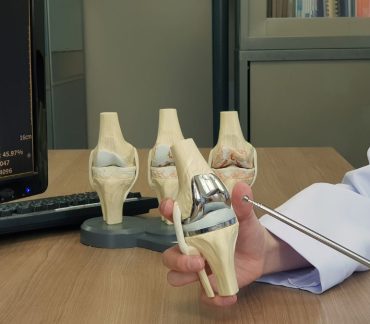 Arthroscopy vs Knee Replacement