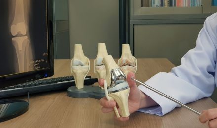 Arthroscopy vs Knee Replacement